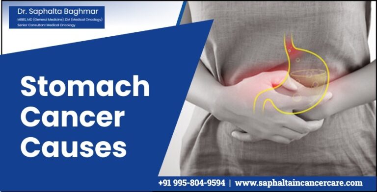 Stomach Cancer Causes & Symptoms