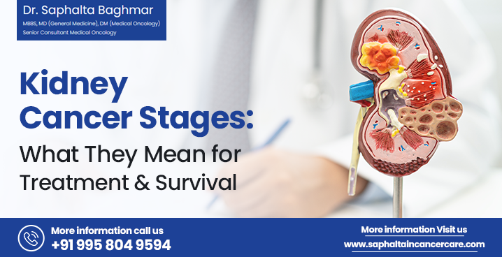 Kidney cancer stages, treatment and survival