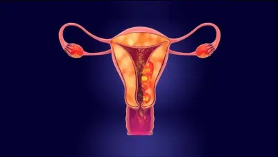 Uterine Cancer Treatment By Dr. Saphalta Baghmar